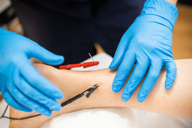 Pro Physical Therapy Dry Needling Marshall County Kentucky